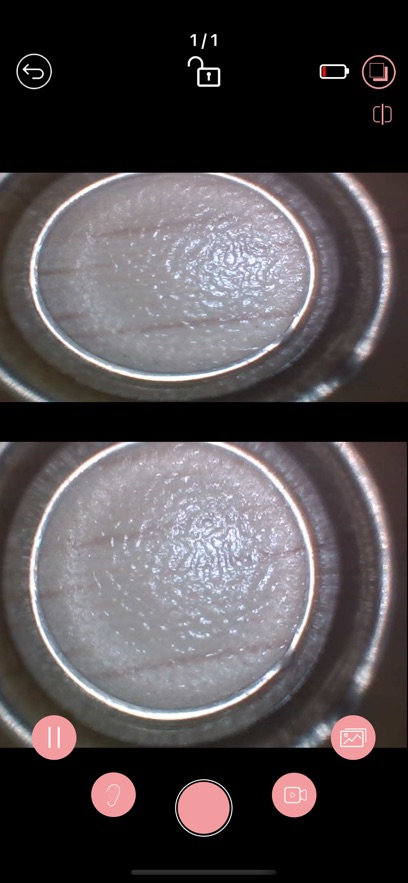 iTiMO耳镜app安卓免费下载