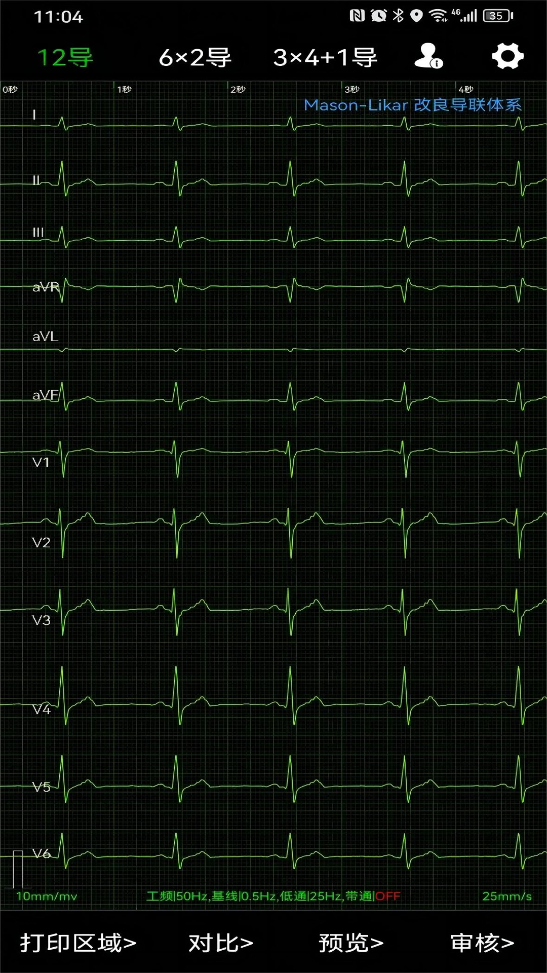 心电一张网 心电一张网