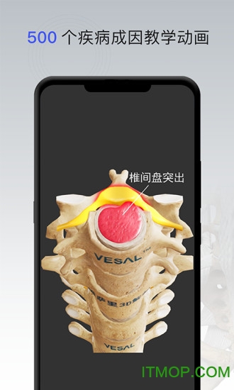 维萨里骨科专家 维萨里骨科专家