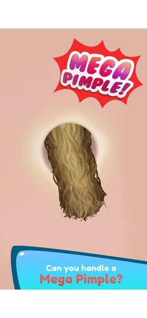 挤痘痘达人 挤痘痘达人