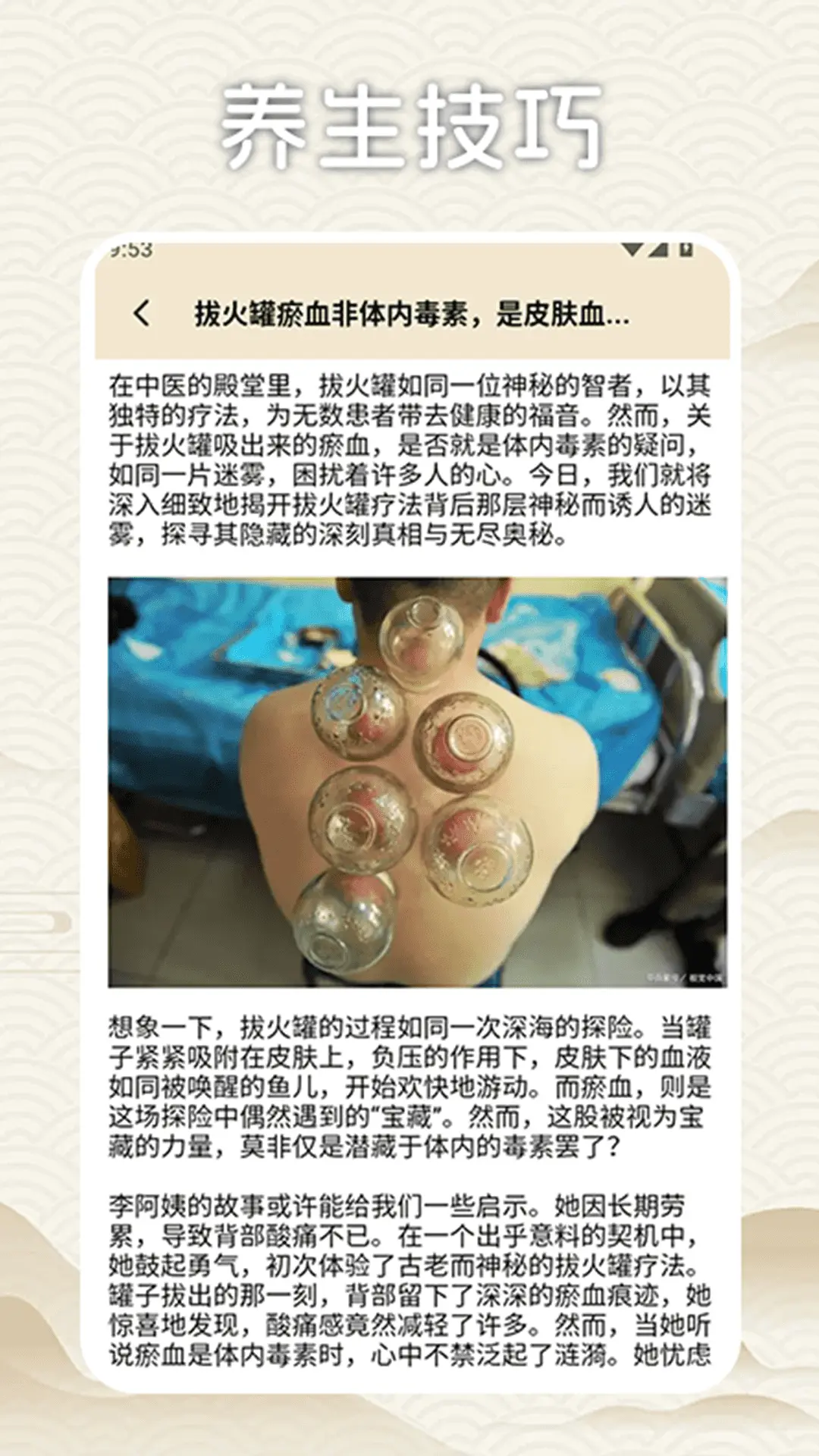 拔罐高手我最行