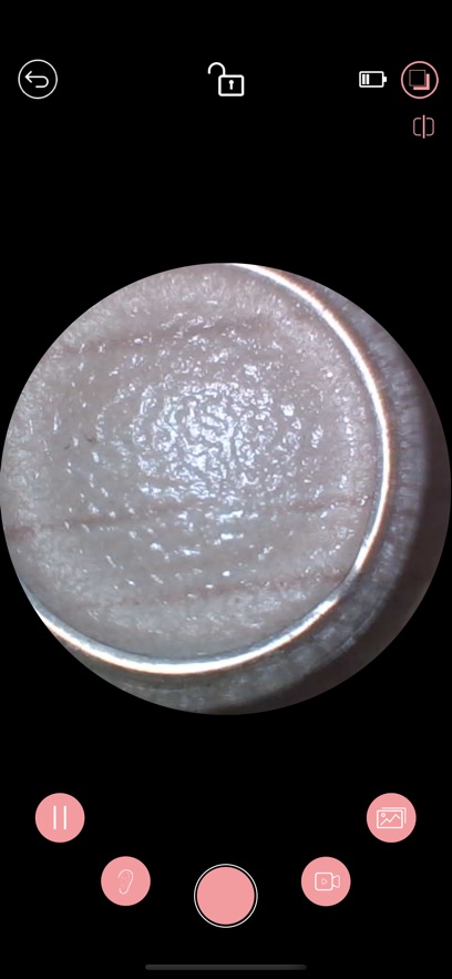 iTiMO耳镜app安卓免费下载